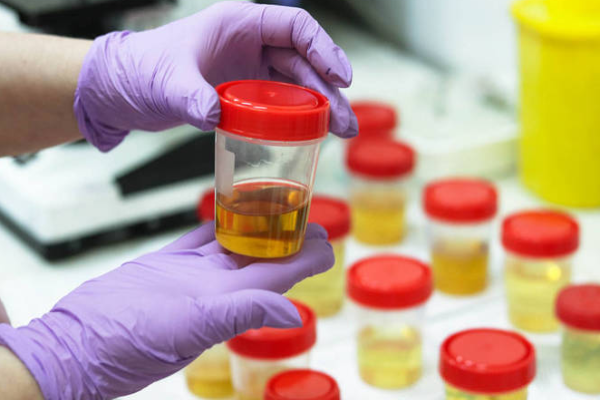 8d4a21947dedeb613b8aefcc7cf0f719.png 试管婴儿男的检查什么项目好