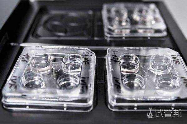 9f407905ce3af3bb4c1f6cd7a6edd243.png 多囊卵巢综合征做试管婴儿是优势还是劣势