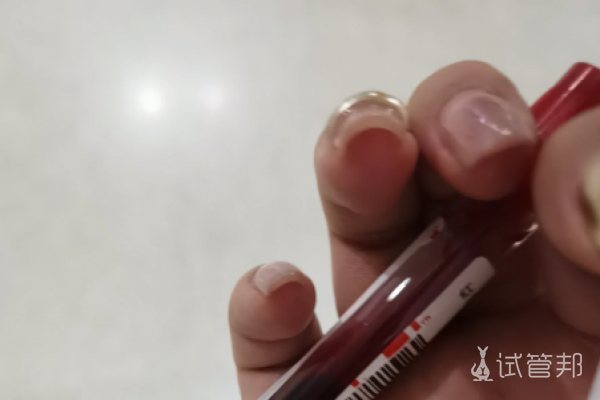 dc1a811d3b36f95bf448325b8ff410d7.png 试管婴儿经历分享