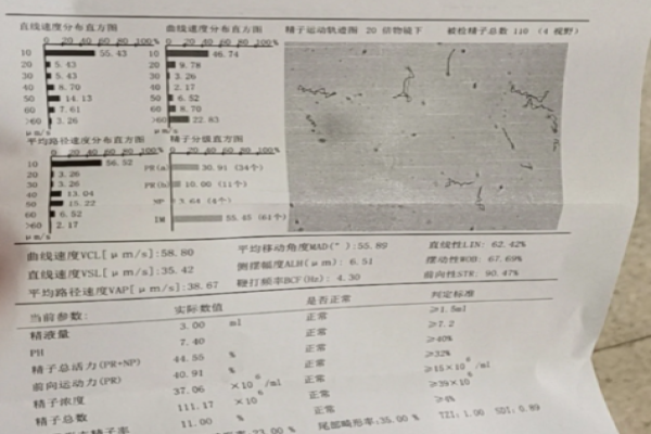 确诊多囊以及精子不液化怀孕太难了