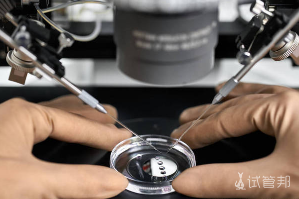 2a502d6107951e9ec6094af1f75184c4.png 深圳二代试管婴儿多少钱