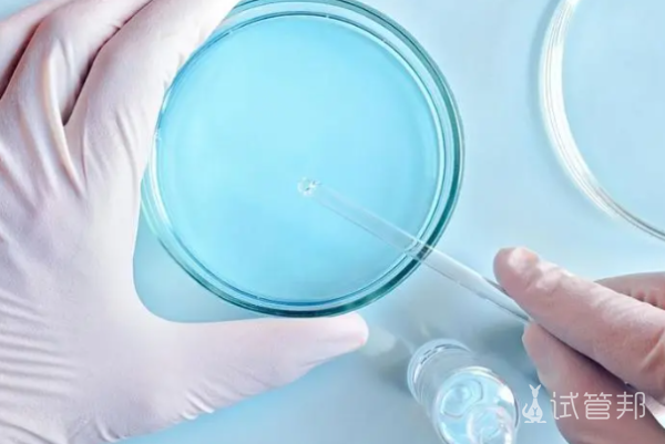 3af5378da232d22b630f42d66d69e2f1.png 男性染色体异常可以做试管婴儿吗