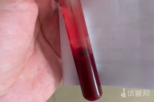 1fc1d6effb633bed40ad2611cc1f7c32.png 4年试管才怀上宝宝这一路真的不容易