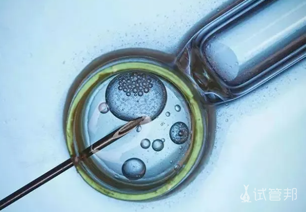 试管婴儿染色体异常可以移植吗