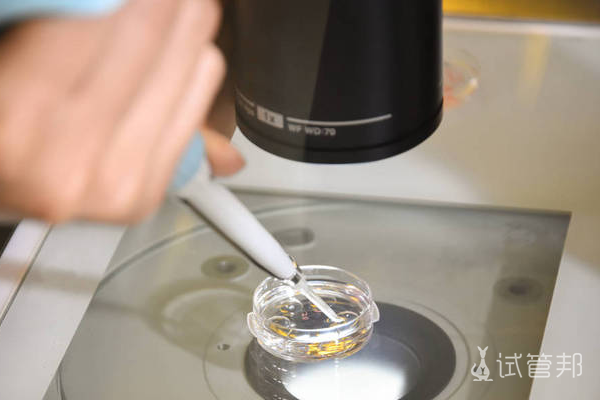 213e3dd1451e038f8bd79f7153b807e8.png 多囊适合做人工授精还是试管