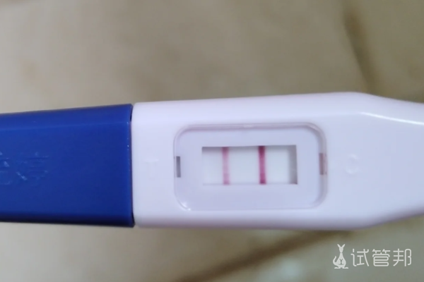 ef76236f7d3701de396d264b7b32acab.png 老公精子畸形最终决定做试管婴儿