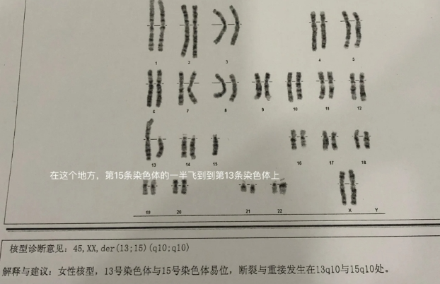 胎停2次才知道是老公染色体易位导致的