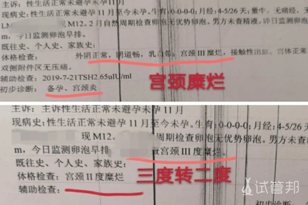 57be2dd2cf9c60b0779dff9d4b204cd6.png 宫颈糜烂三度用药17天后转为二度