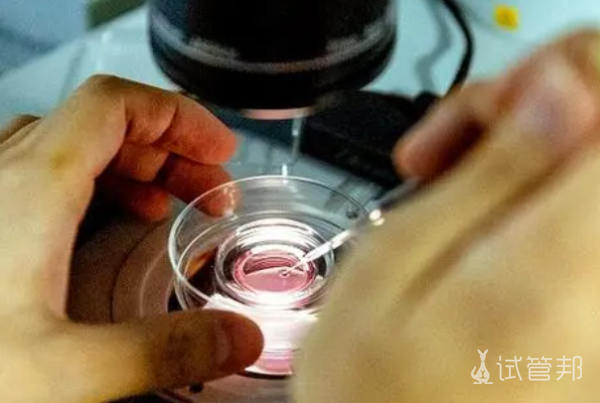 0c86c6608580f46513d9e8b01d3bc9fa.png 中国做试管需要结婚证吗