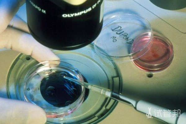 1e711b7d0e25aeb433846321f2ff093e.png 中国做试管婴儿成功率有47.24%吗