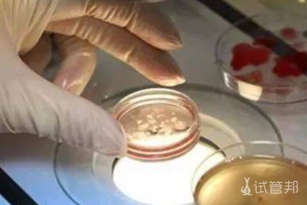 d9c7c7e7e9a2174532fd6987ef51cfdd.png 北京301总医院试管婴儿专家介绍