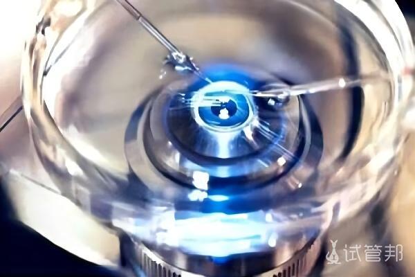 f906e539c6ef7e537659a9f920a4785b.jpeg 试管婴儿的影响因素有哪些