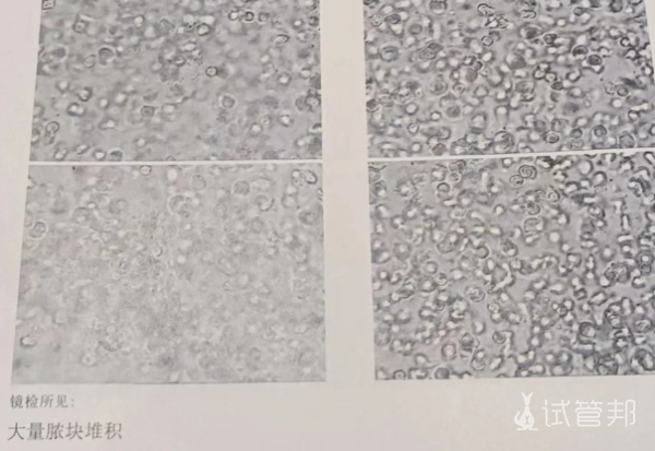 a33e6fbb309ec3e2b7ee44df8cc5ac51.png 前列腺炎又复发了要怎么才能治好呀