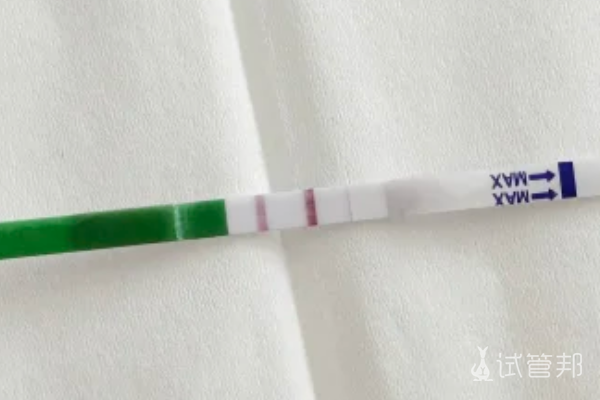 630517b66ae6ce5466f09ac483a9c069.png 分享我的试管婴儿经历