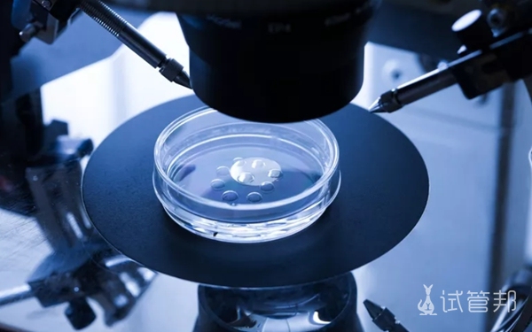 19348476d660df5d04cba21f2b4aaddb.jpg 附上海试管婴儿价目表