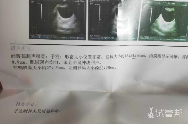 在深圳市人民医院试管一次成功
