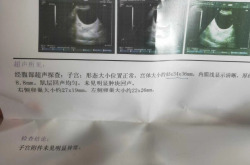 在深圳市人民医院试管一次成功，没曾想我也能这么轻松怀上孩子！