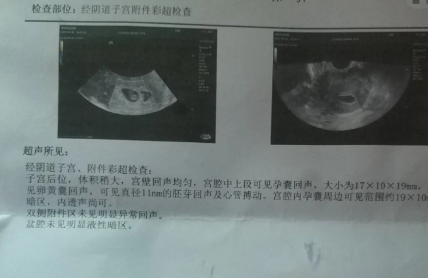 谁说卵子质量不好不能拥有自己的宝宝