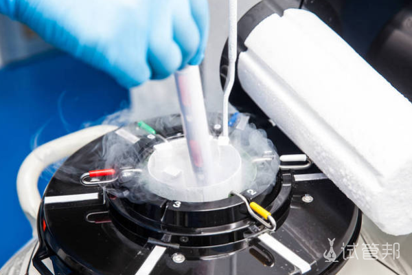 e34eea5d959ea2611b7fa2a0b073cc91.png 单身女性能冻卵保存生育力吗