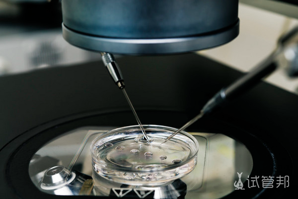 94edee1d22f3a89b3726454bf0d8f25f.png 第三代试管女性受罪吗