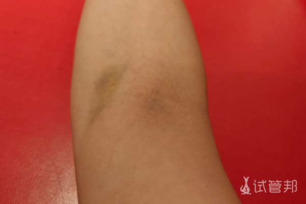 dd8680a1a4d0594f9820f87736d887d6.png 三代试管婴儿详细费用分享