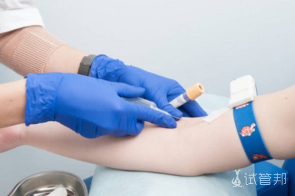 1d20b516baf676063af80829ba519691.png 女性激素检查多少钱