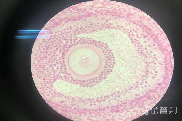 6d2f58609be6eac2f7a6d1f8c4ceac6a.jpeg 卵泡一天能长多少mm