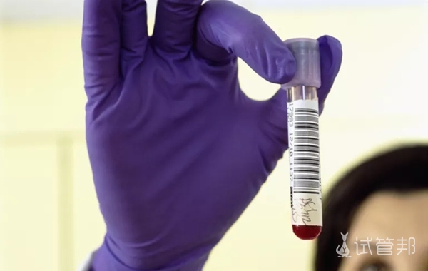 d81fa57e96f15e6d7758123aeb83c7bd.jpg 女性第二代试管婴儿性激素六项检查时间