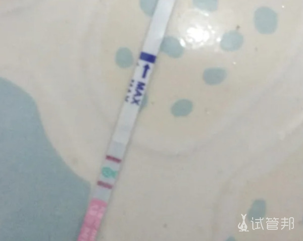 在枣庄市妇幼保健院终于试管婴儿成功了详细流程分享