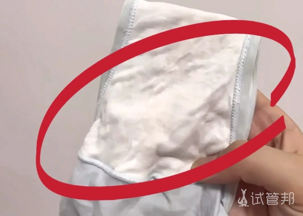 1ea5c6ded8adfbf652c9e51426c44954.png 白带增多别担心我们一起来揭开白带增多背后的秘密吧