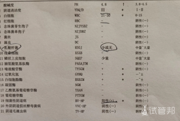 d03729a7f5f8f5e8ab2e46eff643ffbd.png 女生白带量多姐妹们要知道这几类食物务必少碰