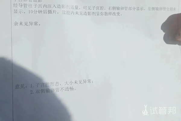 220d80116c22be6a67581fe01b901331.png 输卵管通不通自查用这4个方法