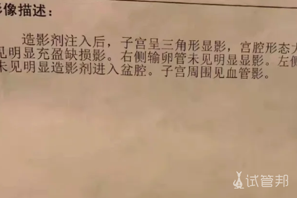 b6d3e74cd5e2608c235f29c73f5f1841.png 输卵管堵塞找对了医生自怀了