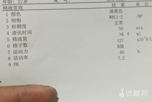 00afaebfaa794f833ae6fd4c71224099.png 2级精索静脉曲张竟然治愈了