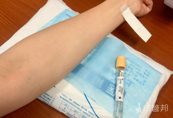 d2858bae8567d6213f5abbec4d4855ea.png 结婚四年一直不孕没想到竟是因为抗精子抗体