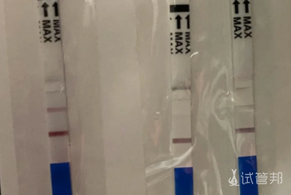 df3793523dad7ee6f30c59882adf8731.png 备孕路上的绊脚石抗精子抗体