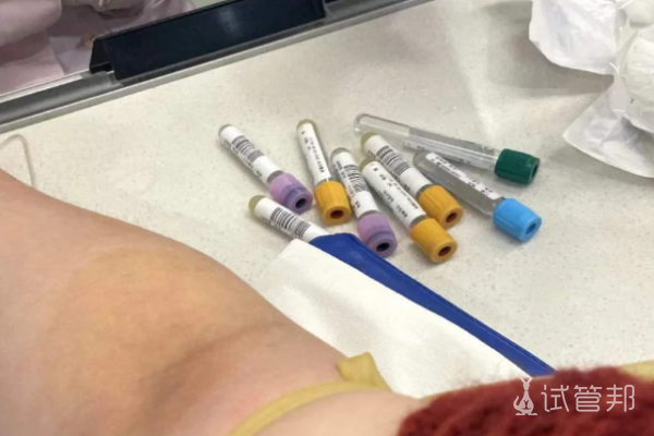 e51e04eae340649d785113d9f1d3f240.png 试管婴儿想要1次成功