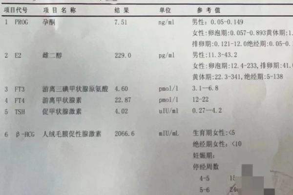 57c0154a93cde757bfb21ff106f7d7cf.png 试管婴儿经验分享之取卵需要知道的一些事
