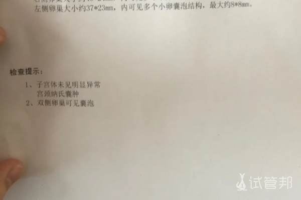 554045e3f8da144a647dcfc3a652af10.png 宫颈囊肿的原因竟然是这个