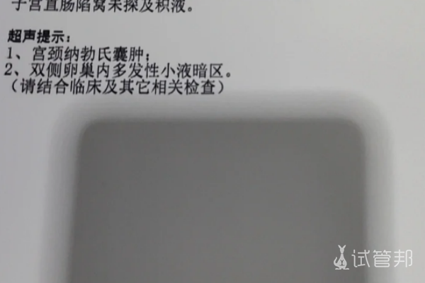 ed32e1114125a070982bdafa1b105046.png 宫颈纳氏囊肿是什么