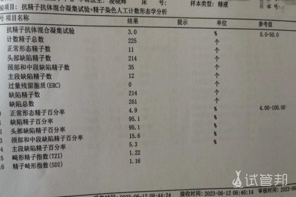 4e1382af5e1feb1065f8565b6a6fe207.png 备孕时老公必须要做精液检查吗