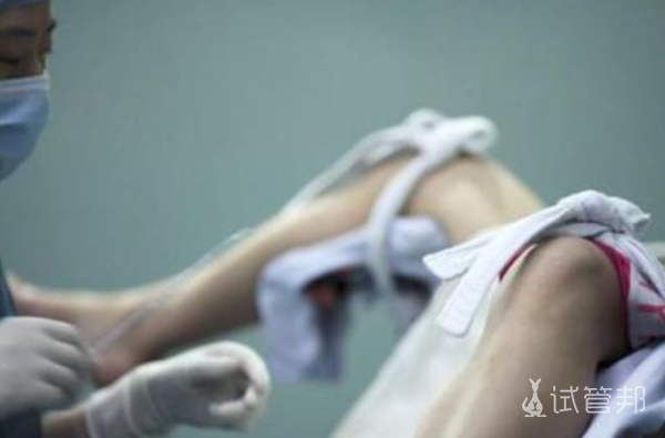 741ac154b5ec60e23996972df7a30f69.png 不孕不育检查项目有哪些