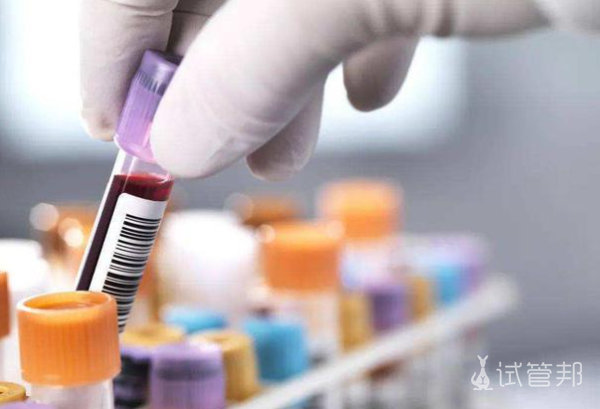 ad023a2a251cd3c2f1a309b2e1e2231d.png 女性激素六项什么时候检查最准确