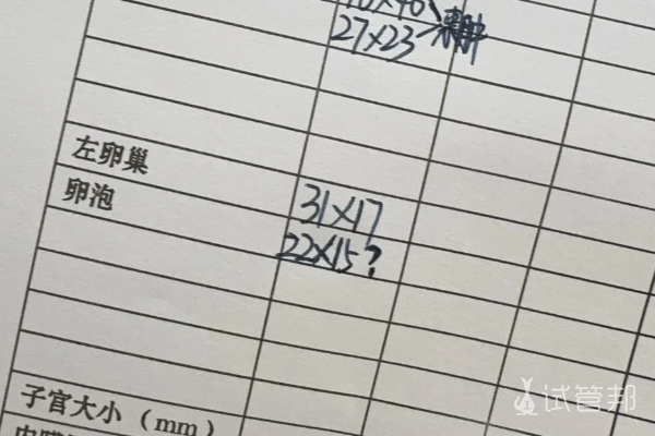 7f65318b4d2db5c652dcf57806f572c0.png 第一次人工授精失败总结失败原因为下一次做准备