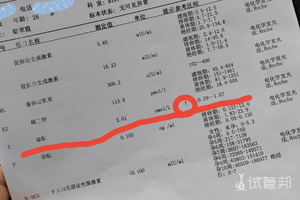 注意备孕前都要检查性激素六项