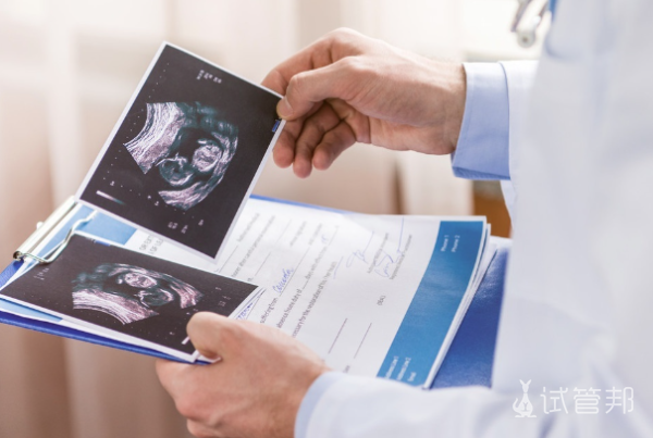 4cbce0c82375ae2cd65aa3c1241d88d6.png 不孕不育检查报告多久出结果