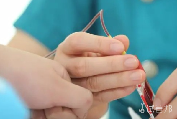 931453641c098187ba368b0a80c57154.png 不孕不育检查结果怎么看