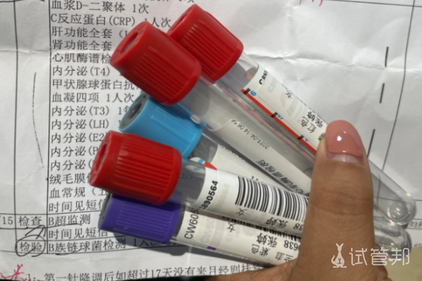 b0cb65a3c2178b954d76e36509185c87.png 决定先试试人工授精