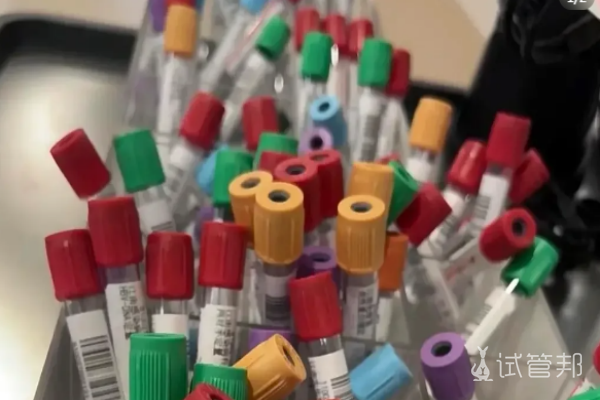 d04420580fc42d8e5f1adf5ecdefae71.png 41岁做三代试管婴儿要二胎