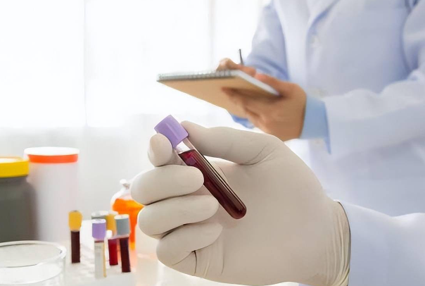 c5a0a3fc5d222540907ed18e08de6c2b.png 性激素六项正常值参考范围